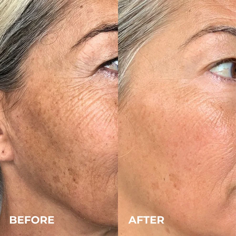 KoreGlow™ Glass Skin Cream