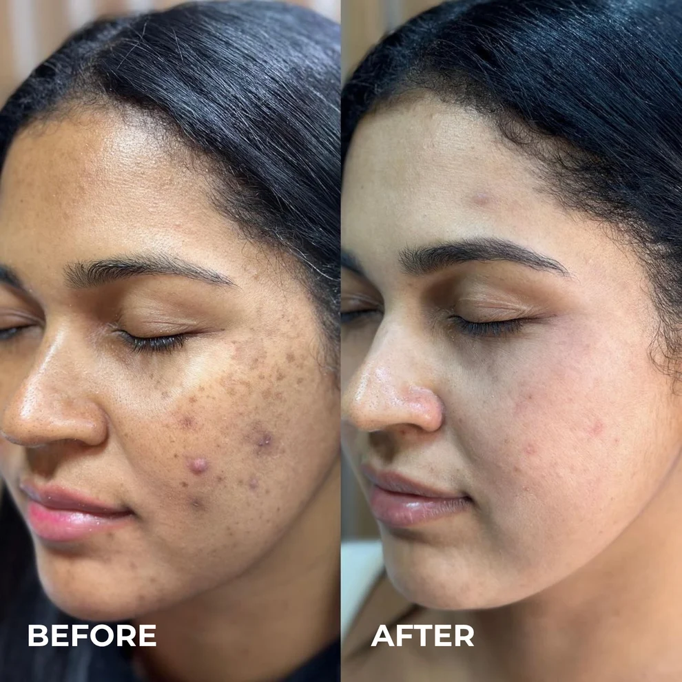 KoreGlow™ Glass Skin Cream