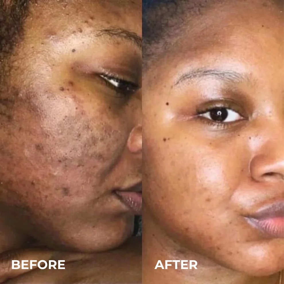 KoreGlow™ Glass Skin Cream