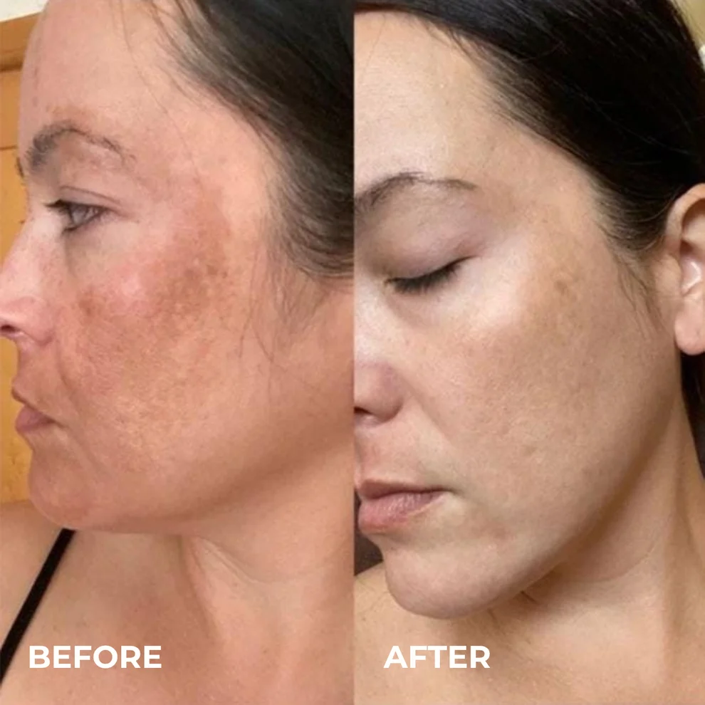 KoreGlow™ Glass Skin Cream